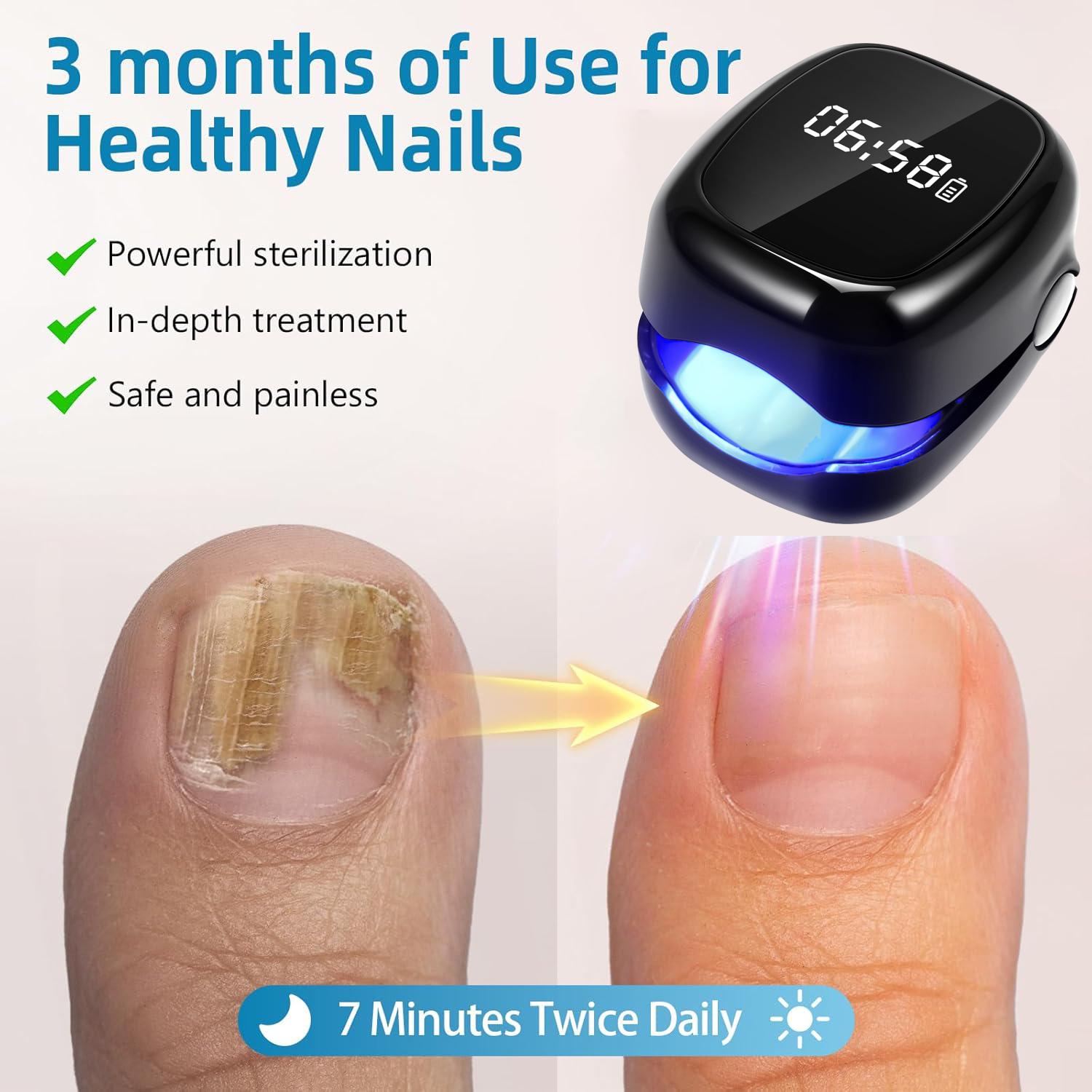 UV Laser Nail Fungus Removal D - Industrial Laser Removal incelemesi ve fiyatı