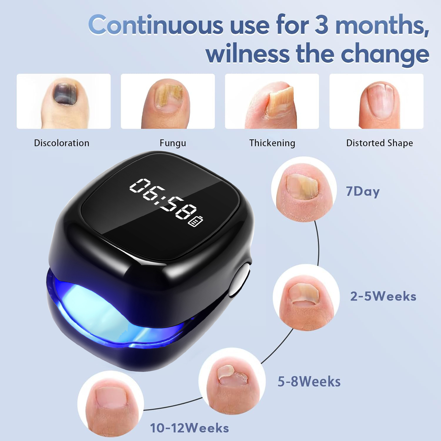 UV Laser Nail Fungus Removal D - Industrial Laser Removal incelemesi ve fiyatı