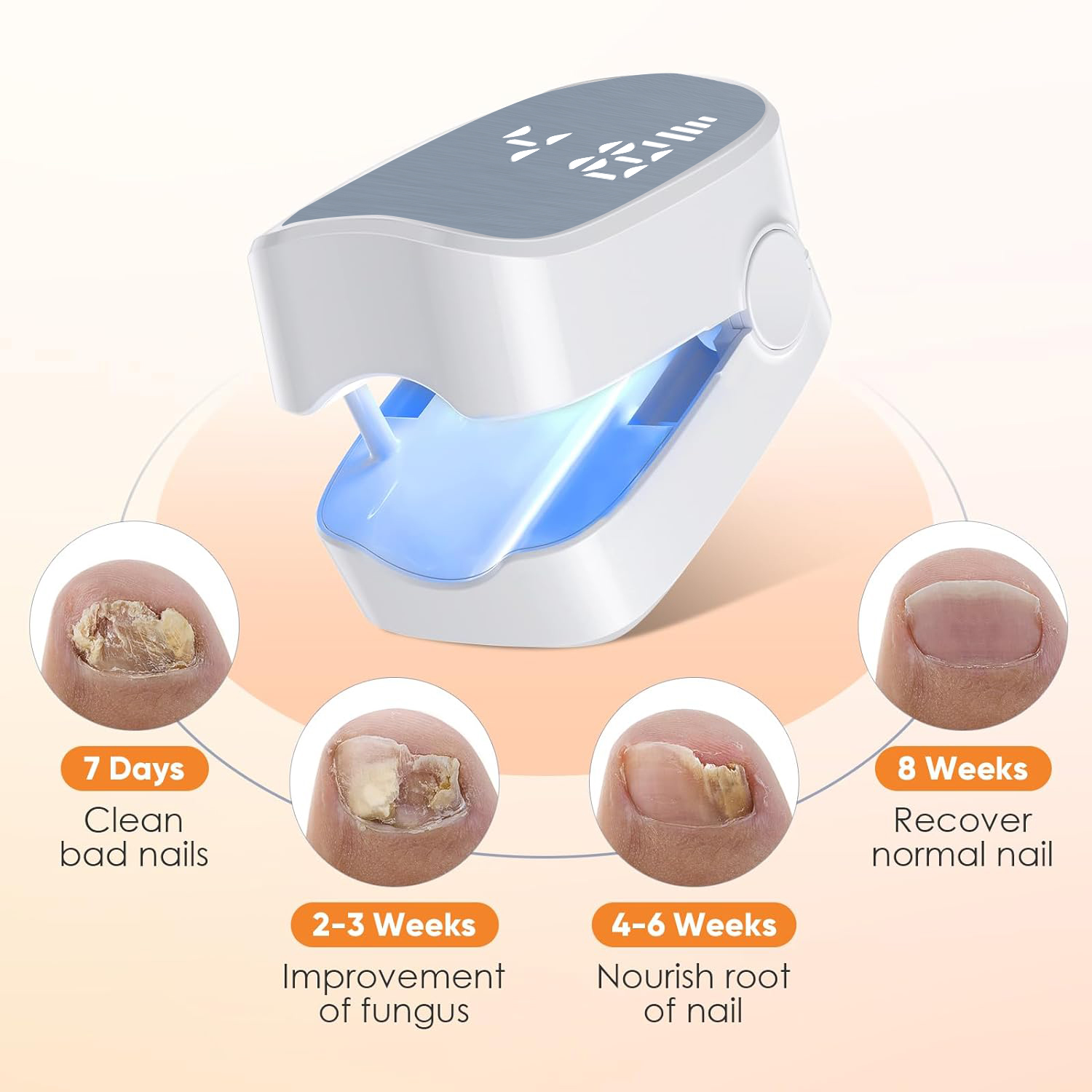 1pcs Effective Rechargeable Na - Industrial Laser Removal incelemesi ve fiyatı