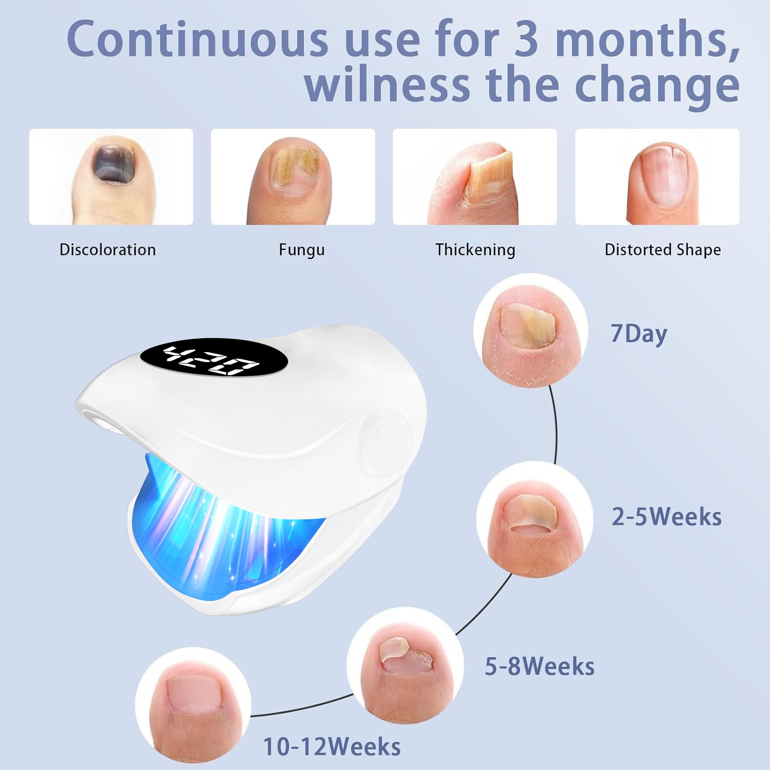Effective Nail Fungus Removal  - Industrial Laser Removal incelemesi ve fiyatı