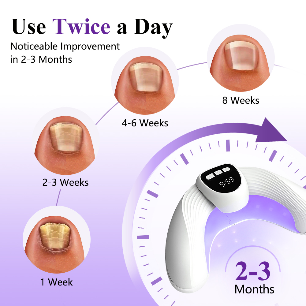 2-in-1 Nail Fungus Laser Devic - Industrial Laser Removal incelemesi ve fiyatı